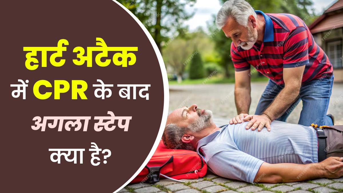 Heart Attack Treatment: हार्ट अटैक में CPR के बाद अगला स्टेप क्या है? जानें पूरा इलाज
