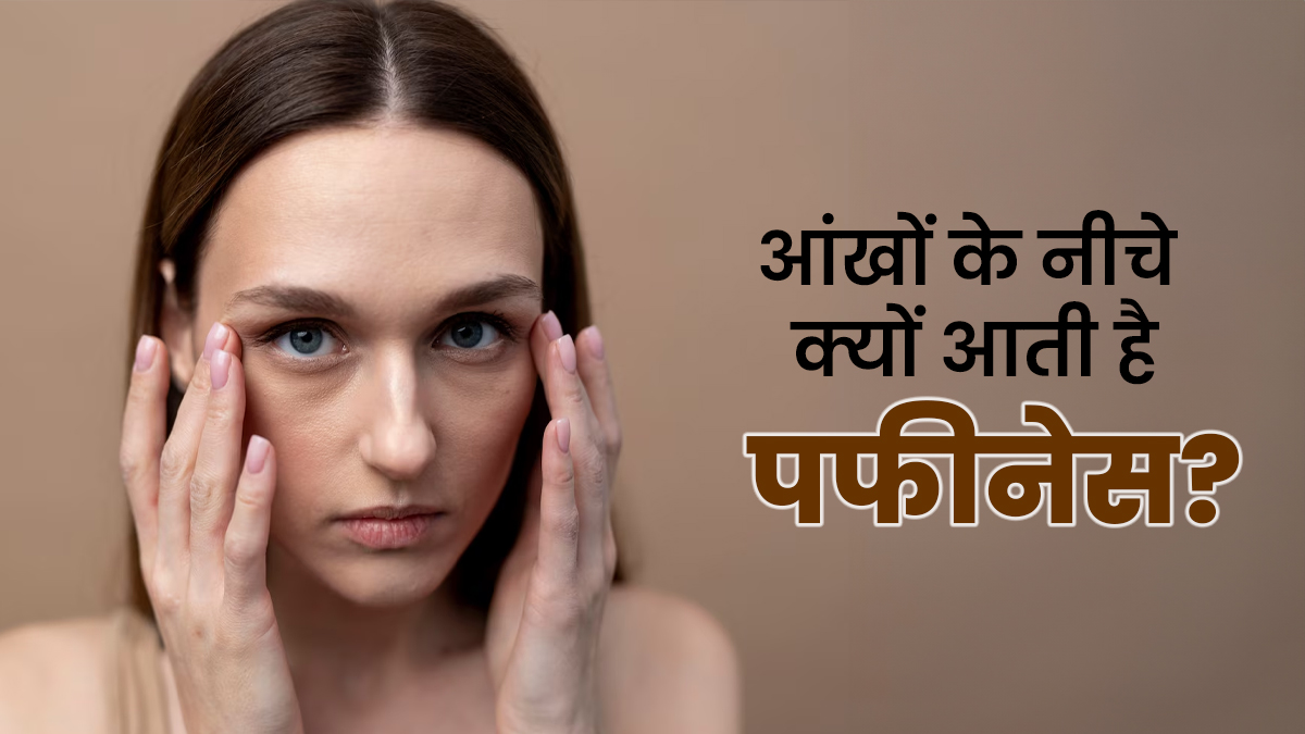 आपकी आंखों के नीचे भी दिखती है सूजन? इसका कारण हो सकती हैं ये परेशानियां