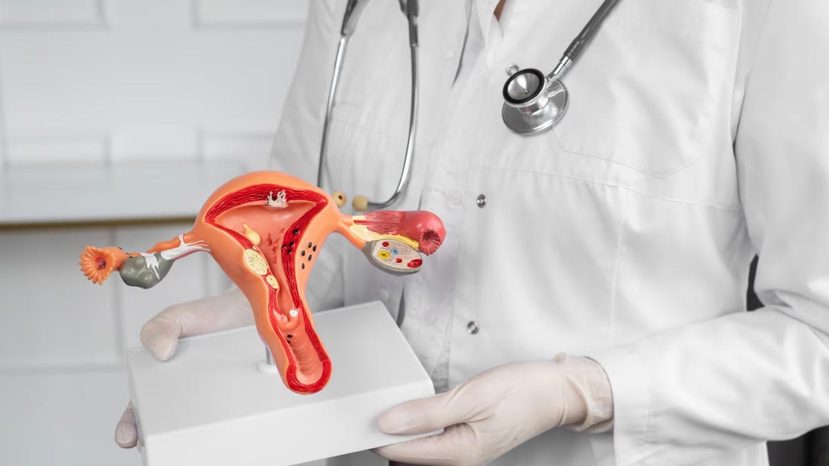 Endometriosis-insidee2