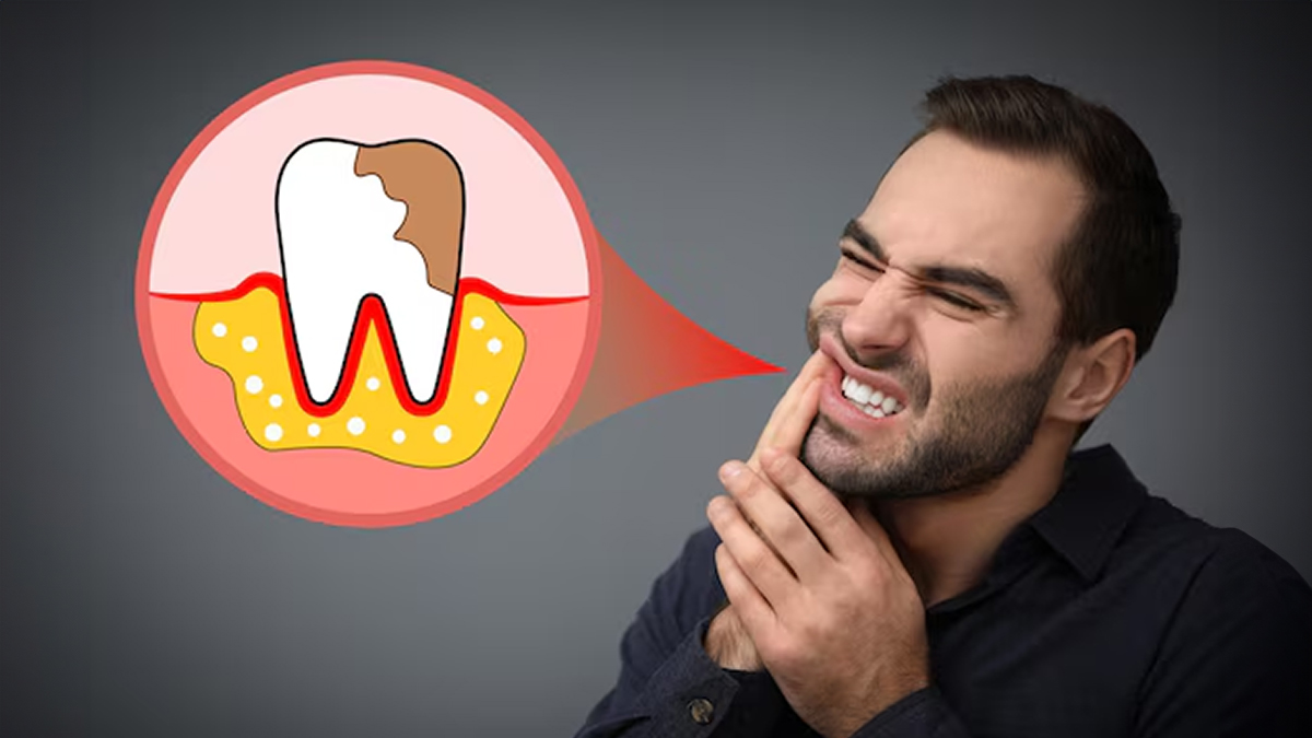 what happens when you ignore a cavity in