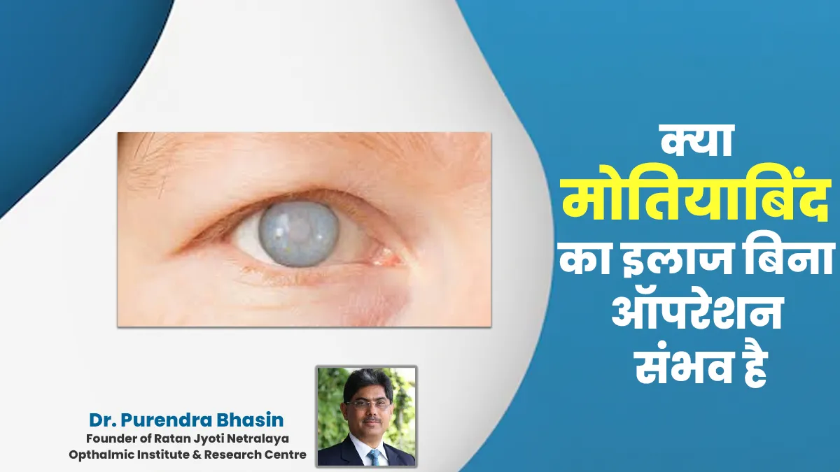 क्या मोतियाबिंद का इलाज बिना ऑपरेशन संभव है? जानें डॉक्टर से