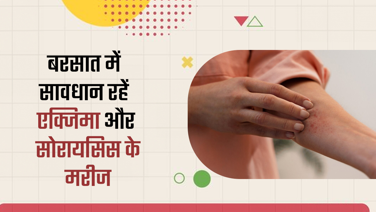 बरसात में एक्जिमा और सोरायसिस से पीड़ित लोग जरूर बरतें ये सावधानियां? खुद डर्मेटोलॉजिस्ट ने बताया