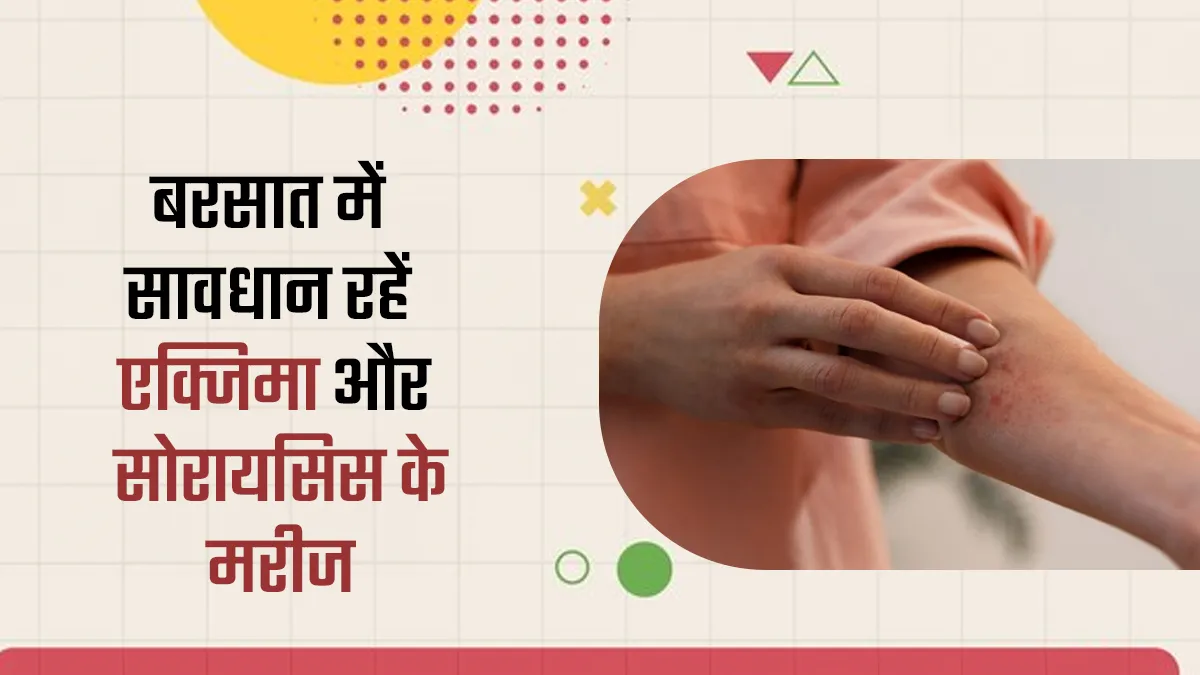 बरसात में एक्जिमा और सोरायसिस से पीड़ित लोग जरूर बरतें ये सावधानियां? खुद डर्मेटोलॉजिस्ट ने बताया