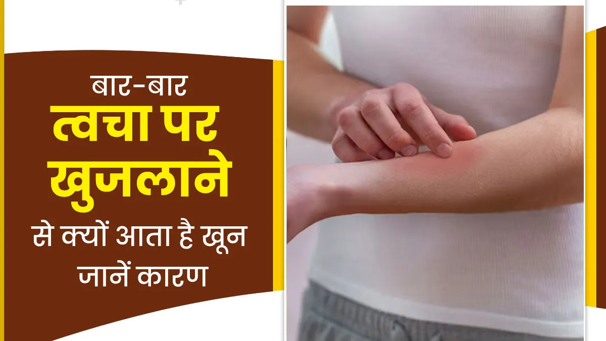 बार-बार खुजलाने पर त्वचा से आ रहा है खून, जानें किस रोग की वजह से होती है यह समस्या