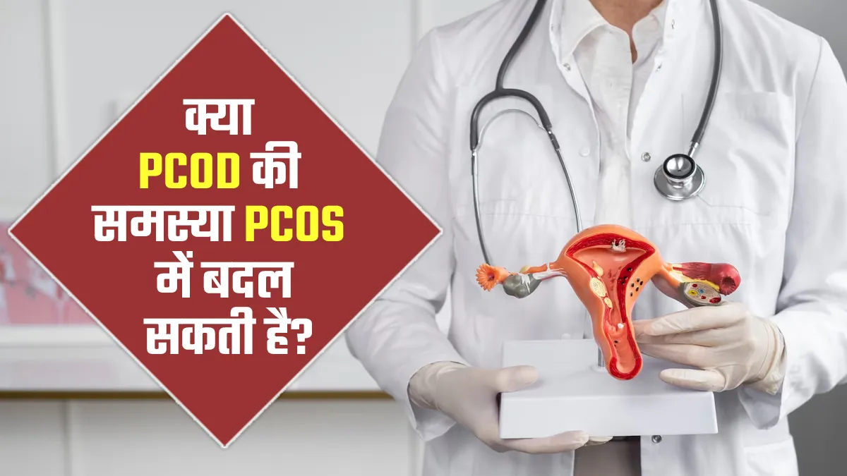 क्या PCOD की समस्या लंबे समय में PCOS में बदल सकती है? डॉक्टर से जानें