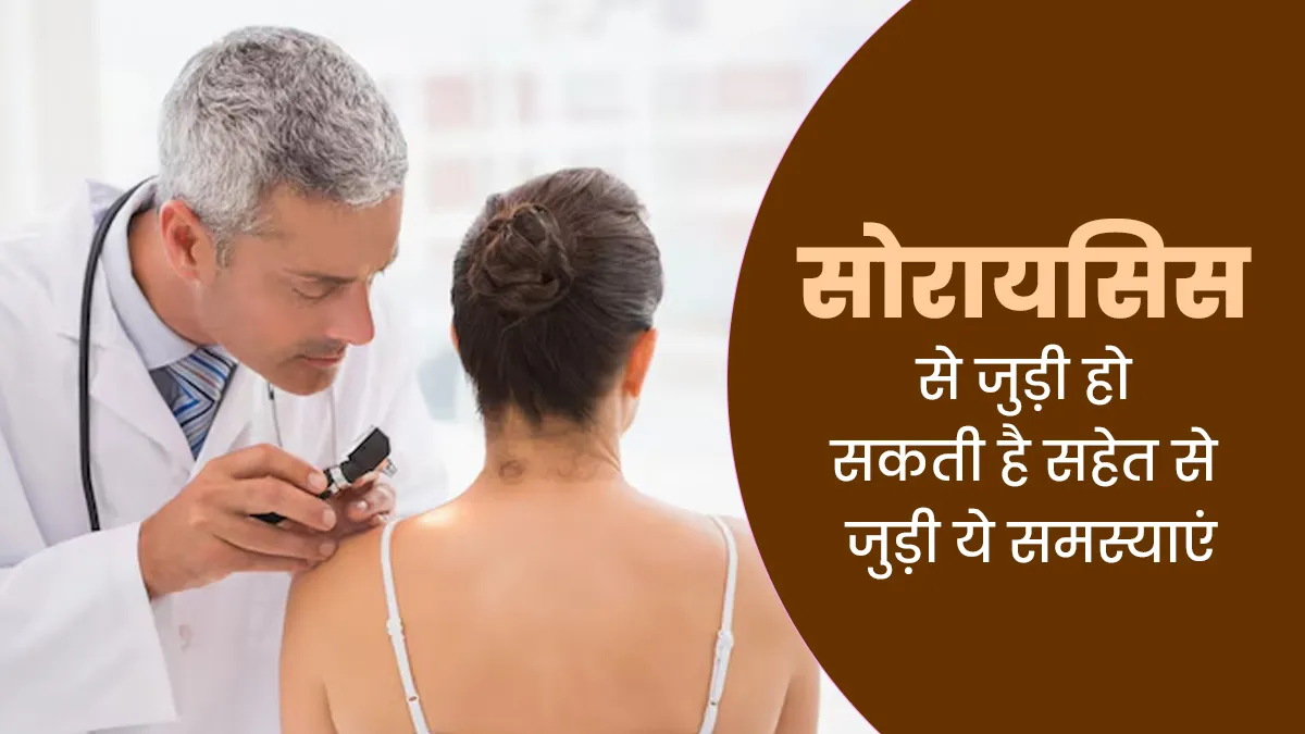 सोरायसिस से जुड़ी हो सकती है सहेत से जुड़ी ये 5 समस्याएं, डॉक्टर से जानें
