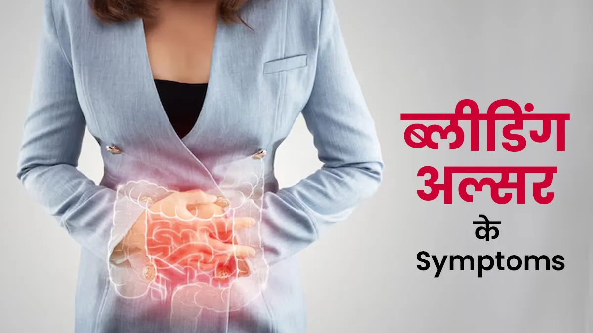 ब्लीडिंग अल्सर होने पर नजर आते हैं ये 3 लक्षण, एक्सपर्ट से जानें ट्रीटमेंट