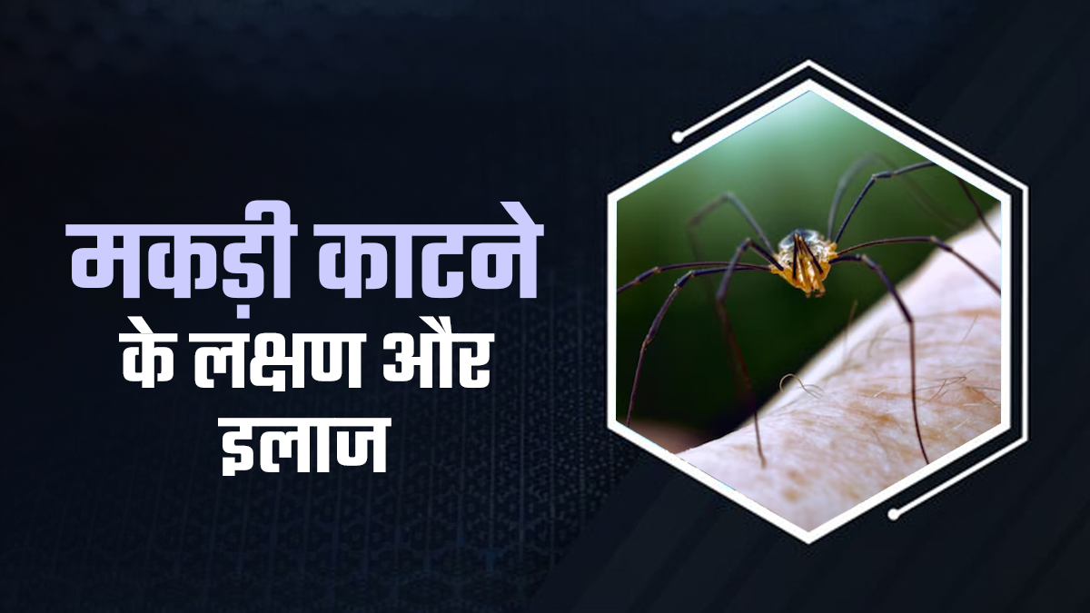 जहरीली मकड़ी के काटने पर नजर आने लगते हैं ये 5 लक्षण, तुरंत इन उपायों से करें इलाज