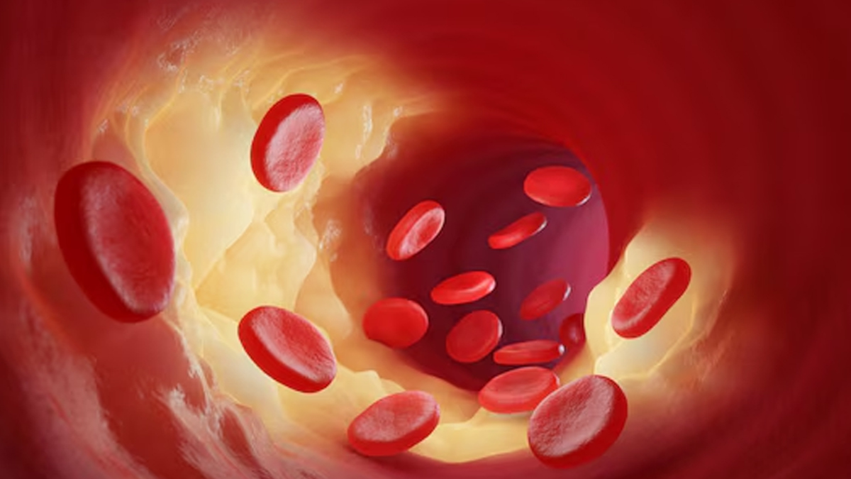 impure blood causes
