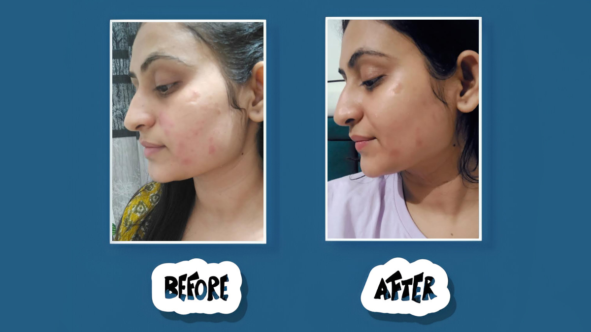 tried-and-tested-home-remedy