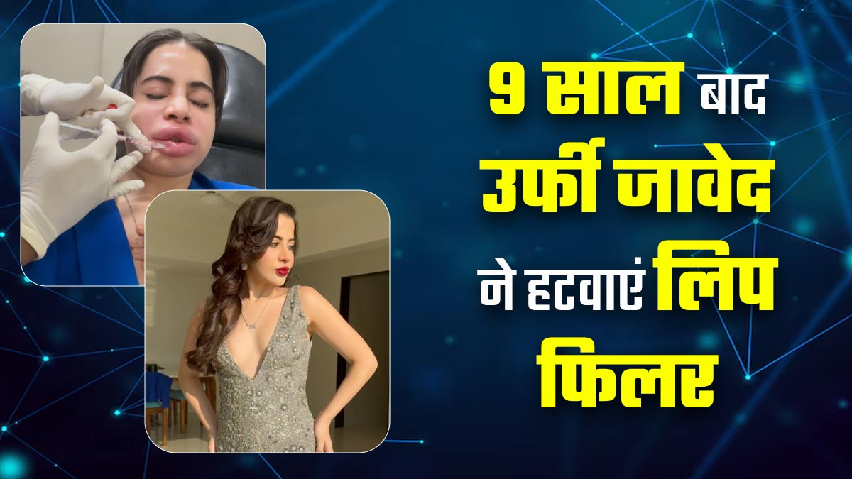 Urfi Javed ने 9 साल बाद हटवाएं लिप फिलर, जानें Lip Fillers हटाने के बाद के साइड इफेक्ट्स
