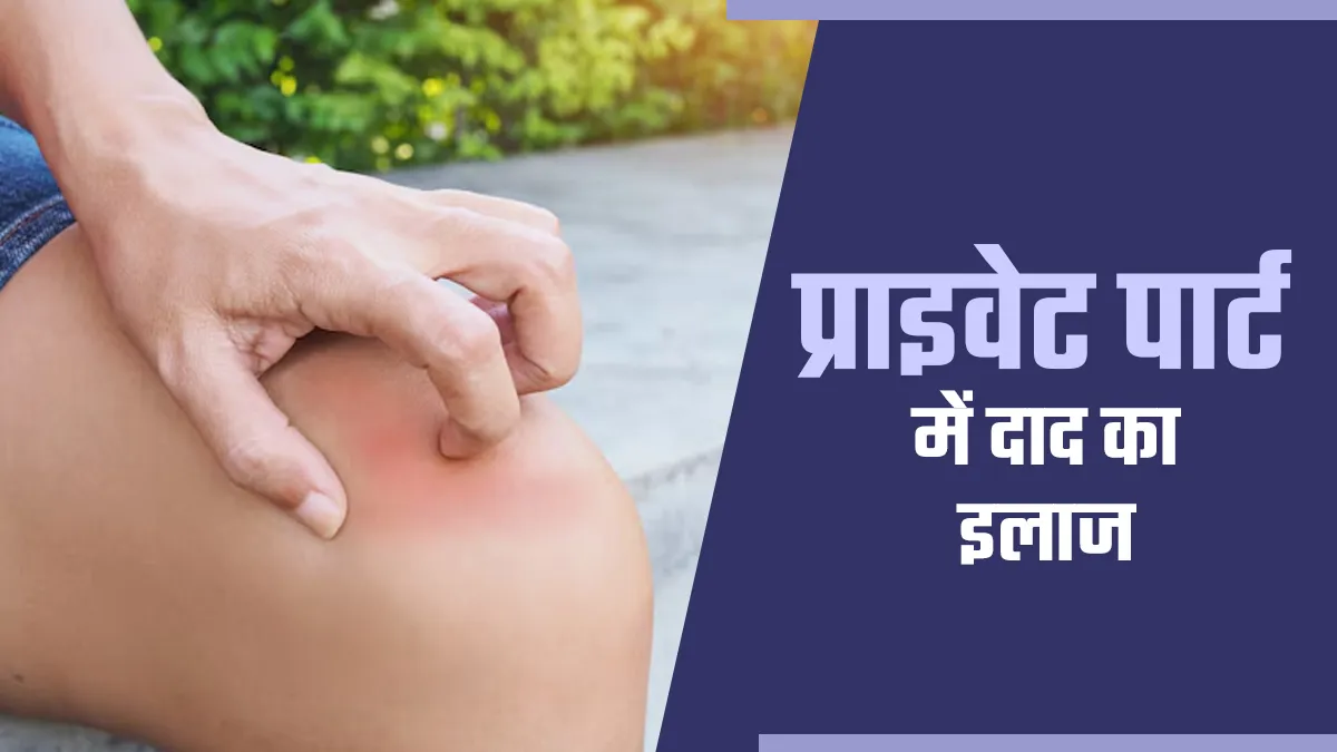 प्राइवेट पार्ट में दाद हो जाए तो कैसे करें इलाज? डॉक्टर से जानें