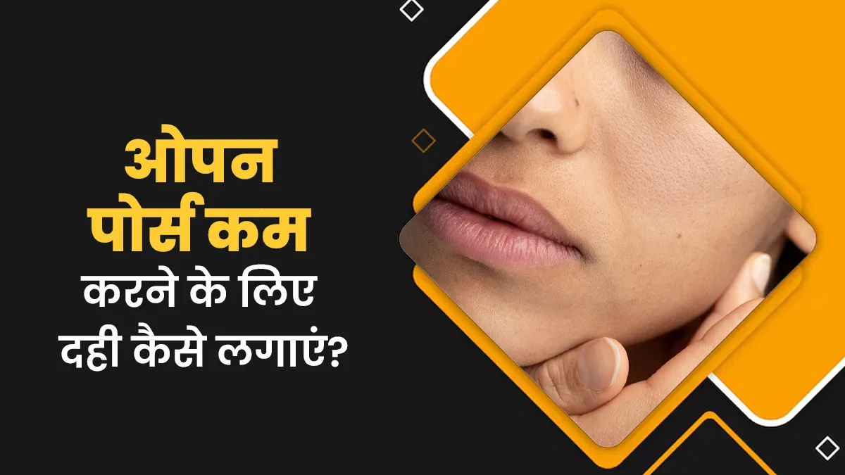 ओपन पोर्स की समस्या से रहते हैं परेशान, तो चेहरे पर इस तरह करें दही का इस्तेमाल