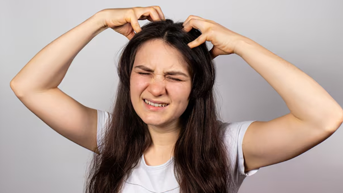 how to reduce scalp itching in monsoon 01 (10)