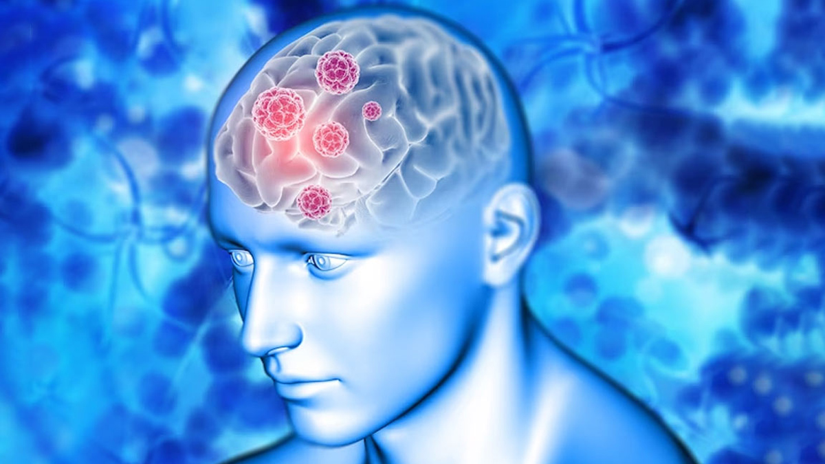 what is chemo brain and how it affects brain development in hindi 1