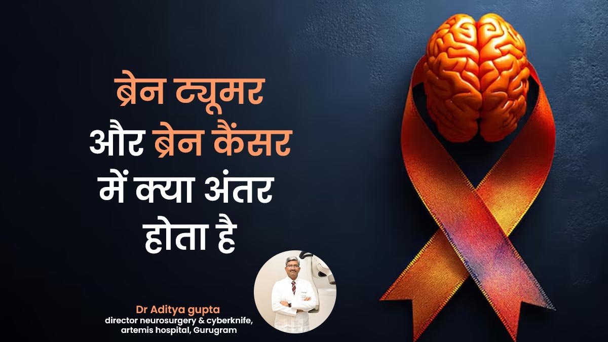 एक- दूसरे से अलग होते हैं ब्रेन ट्यूमर और ब्रेन कैंसर, डॉक्टर ने बताया कौन सा है ज्यादा खतरनाक