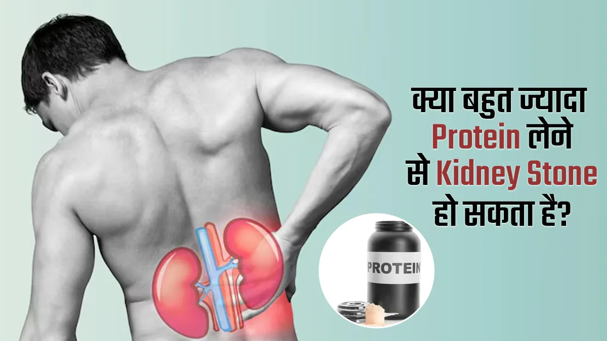 क्या बहुत ज्यादा प्रोटीन लेने से किडनी स्टोन हो सकता है? डॉक्टर बता रहे हैं सच्चाई