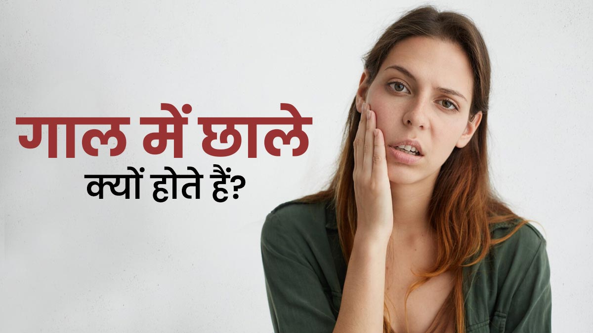 मुंह के अंदर गाल में छाले क्यों होते हैं? डॉक्टर से जानें कारण और बचाव टिप्स