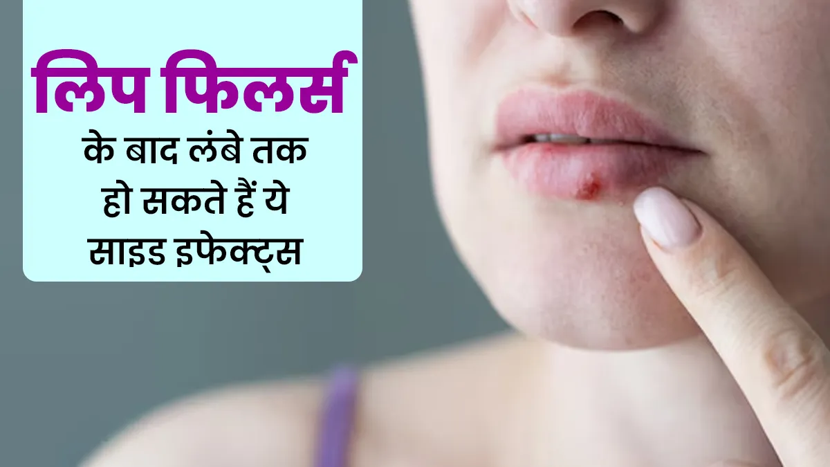 लिप फिलर्स के बाद कुछ महिलाओं को लंबे समय तक हो सकते हैं ये 5 साइड इफेक्ट्स