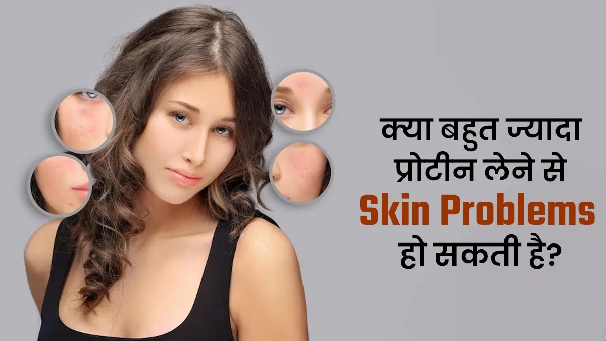 क्या बहुत ज्यादा प्रोटीन लेने के कारण स्किन से जुड़ी परेशानी हो सकती है? जानें क्या कहते हैं एक्सपर्ट
