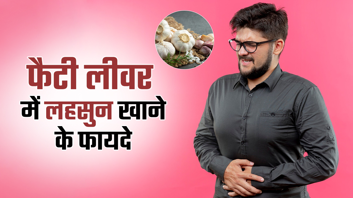 फैटी लिवर में लहसुन खाना हो सकता है फायदेमंद, जानें खाने का सही तरीका