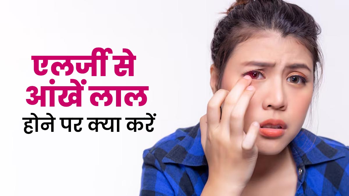 एलर्जी के कारण हो गई हैं आपकी आंखें लाल? छुटकारा पाने के लिए अपनाएं ये 3 टिप्स