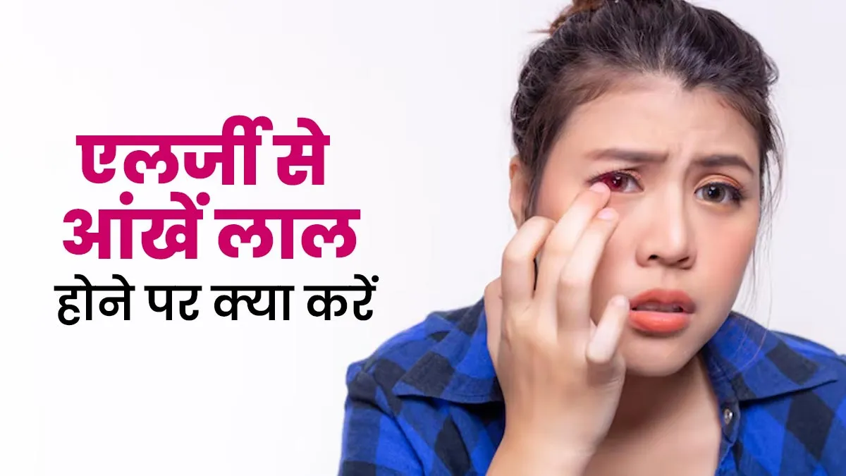 एलर्जी के कारण हो गई हैं आपकी आंखें लाल? छुटकारा पाने के लिए अपनाएं ये 3 टिप्स
