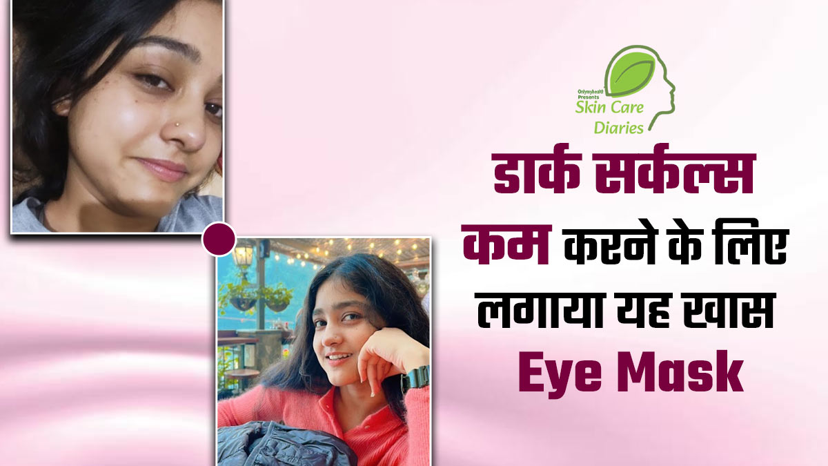 डार्क सर्कल्स कम करने के लिए लक्षिता ने लगाया इन 3 चीजों से बना आई मास्क, एक हफ्ते में दिखा असर
