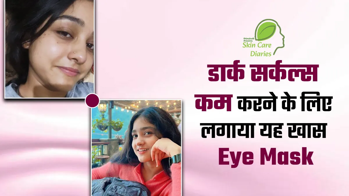डार्क सर्कल्स कम करने के लिए लक्षिता ने लगाया इन 3 चीजों से बना आई मास्क, एक हफ्ते में दिखा असर