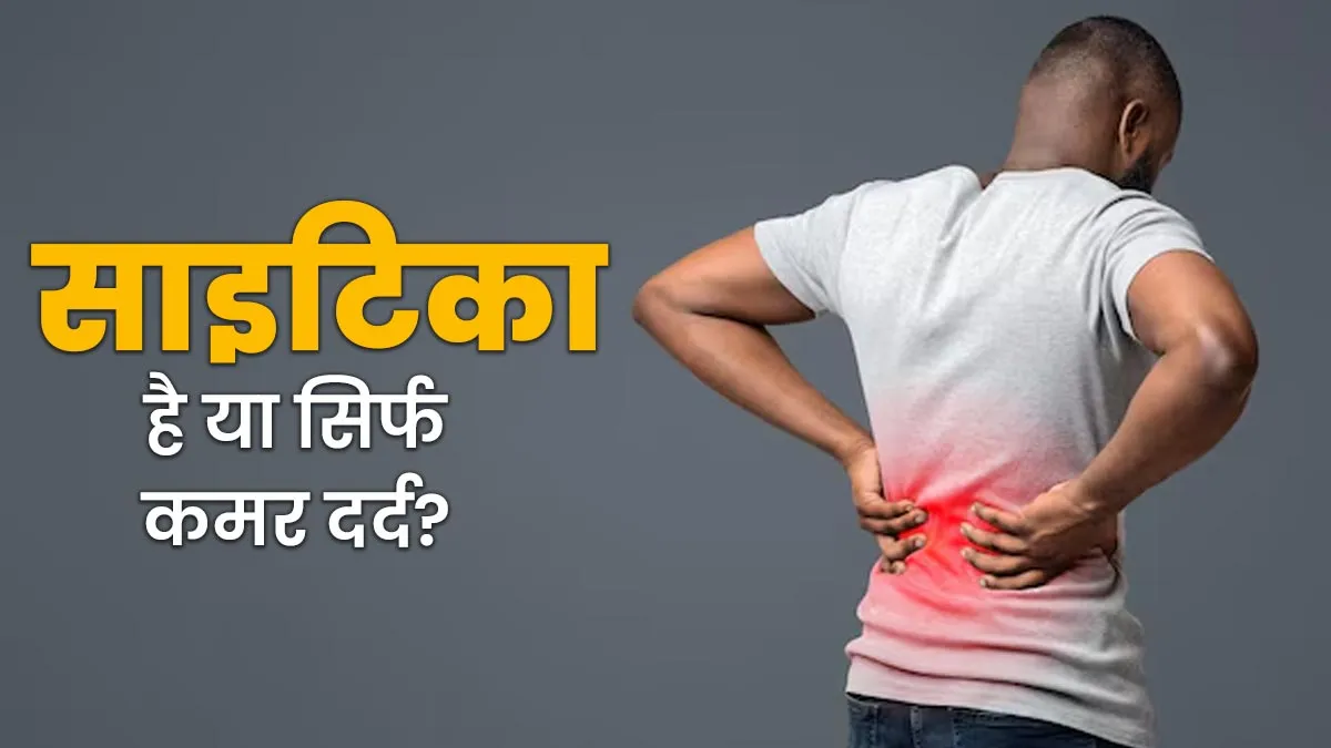 साइटिका है या सिर्फ कमर दर्द? डॉक्‍टर से समझें फर्क वरना इलाज में होगी देरी