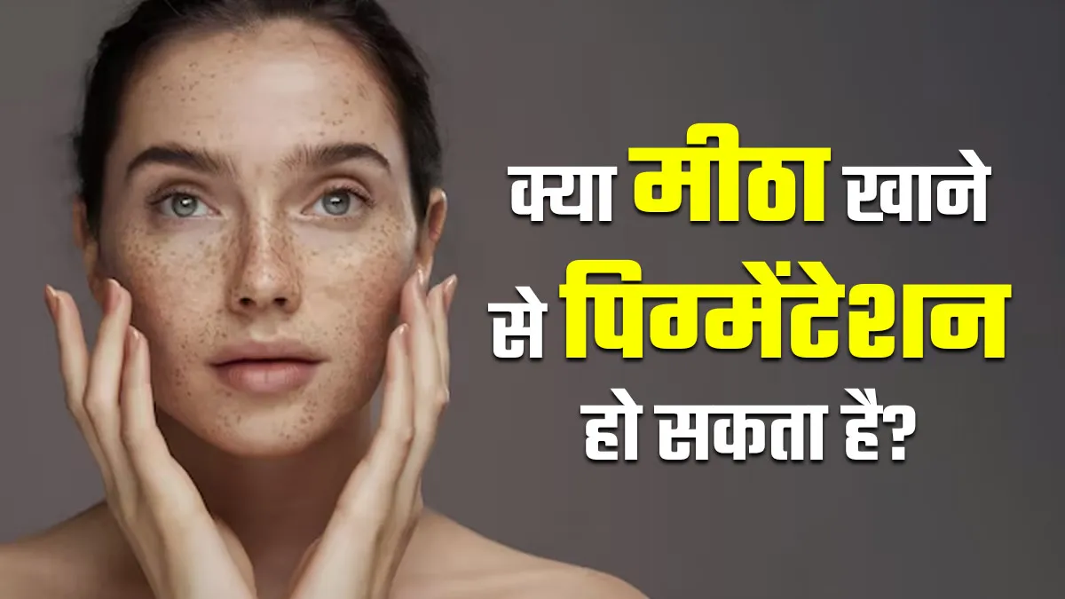 मीठा खाने की वजह से तो नहीं हो रहा आपके चेहर पर पिग्मेंटेशन? जानें क्या कहते हैं डॉक्टर