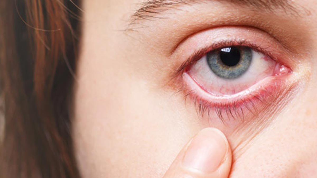 mistakes to avoid if you have swelling near the eyes in hindi 01 (3)