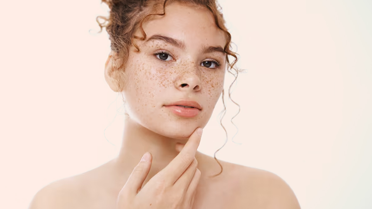 sugar-cause-pigmentation