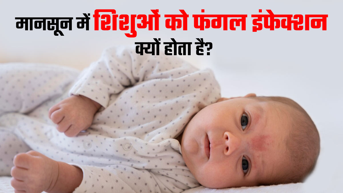 मानसून में शिशुओं को फंगल इंफेक्शन क्यों होता है? डॉक्टर से जानें 5 कारण