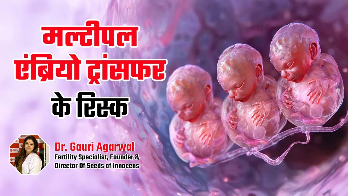 IVF में मल्टीपल एंब्रियो ट्रांसफर (2 से ज्यादा भ्रूण) कितना सुरक्षित है? डॉक्टर से जानें इसके रिस्क