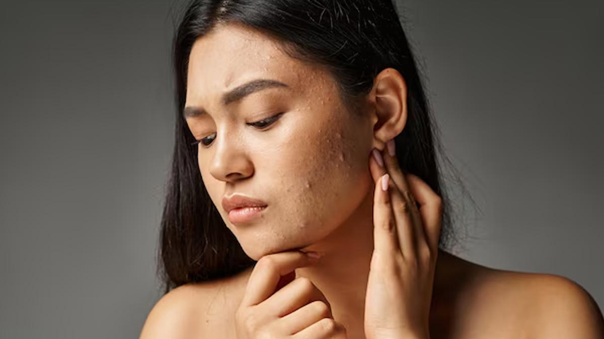 can stress impact collagen levels and skin glow in hindi 01 (3)