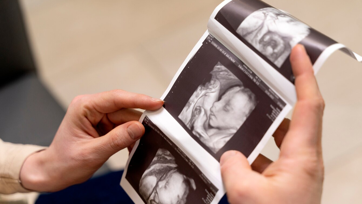 risks-of-multiple-embryo-transfer-inside