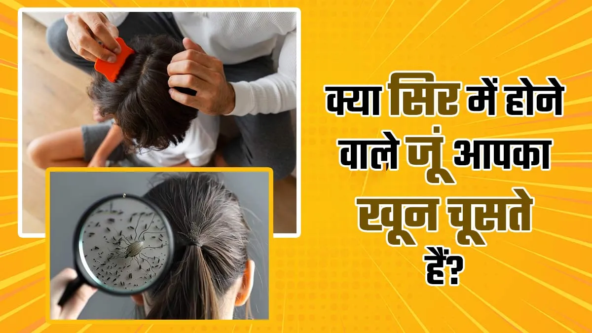 क्या वाकई सिर में होने वाले जूं आपका खून चूसते हैं? जानें डॉक्टर से