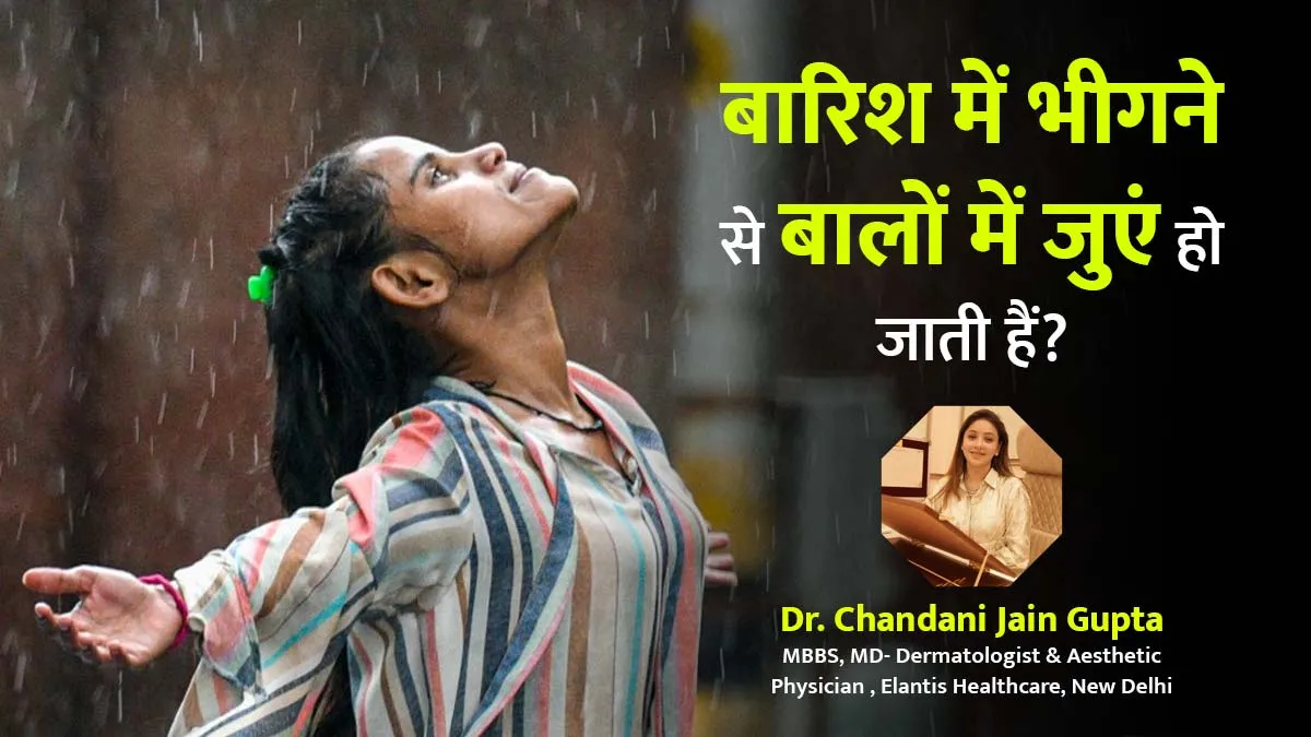 क्या वाकई बारिश में भीगने से बालों में जुएं हो सकते हैं? एक्सपर्ट से जानें इस दावे की सच्चाई
