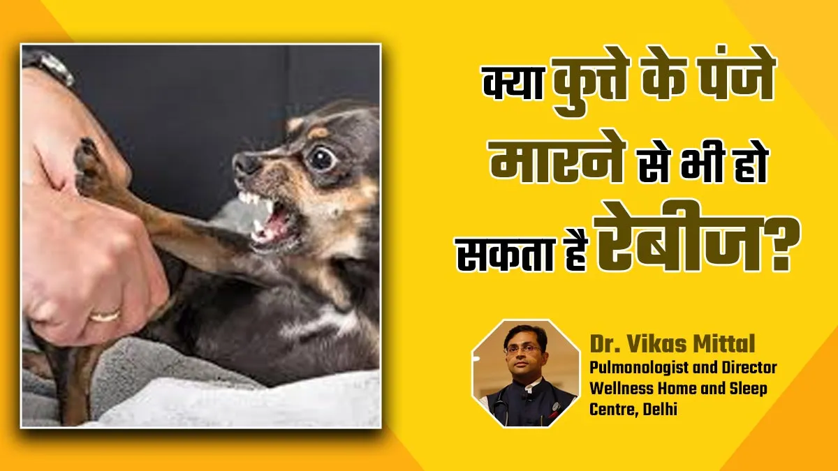 क्या कुत्ते के पंजे मारने से भी हो सकता है रेबीज, डॉक्टर से जानें इसके बारे में