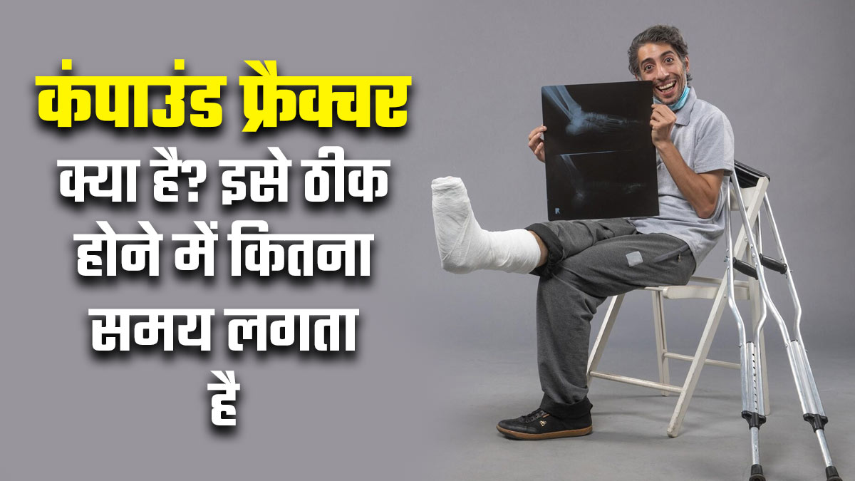 कंपाउंड फ्रैक्चर क्या है? इसे ठीक होने में कितना समय लगता है, डॉक्टर से जानें