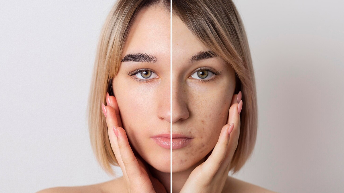 habits that are damaging your skin barrier in hindi 01 (3)