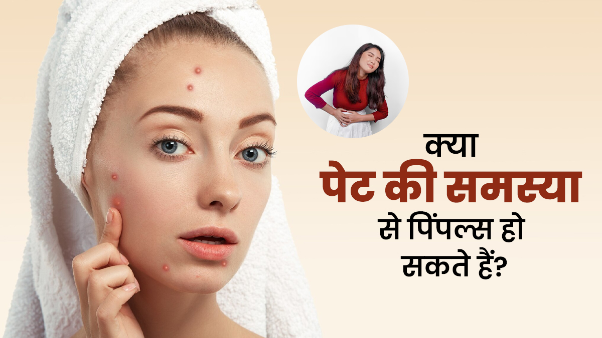 चेहरे पर पिंपल्स होने का पेट से क्या कनेक्शन है? जानें डॉक्टर से