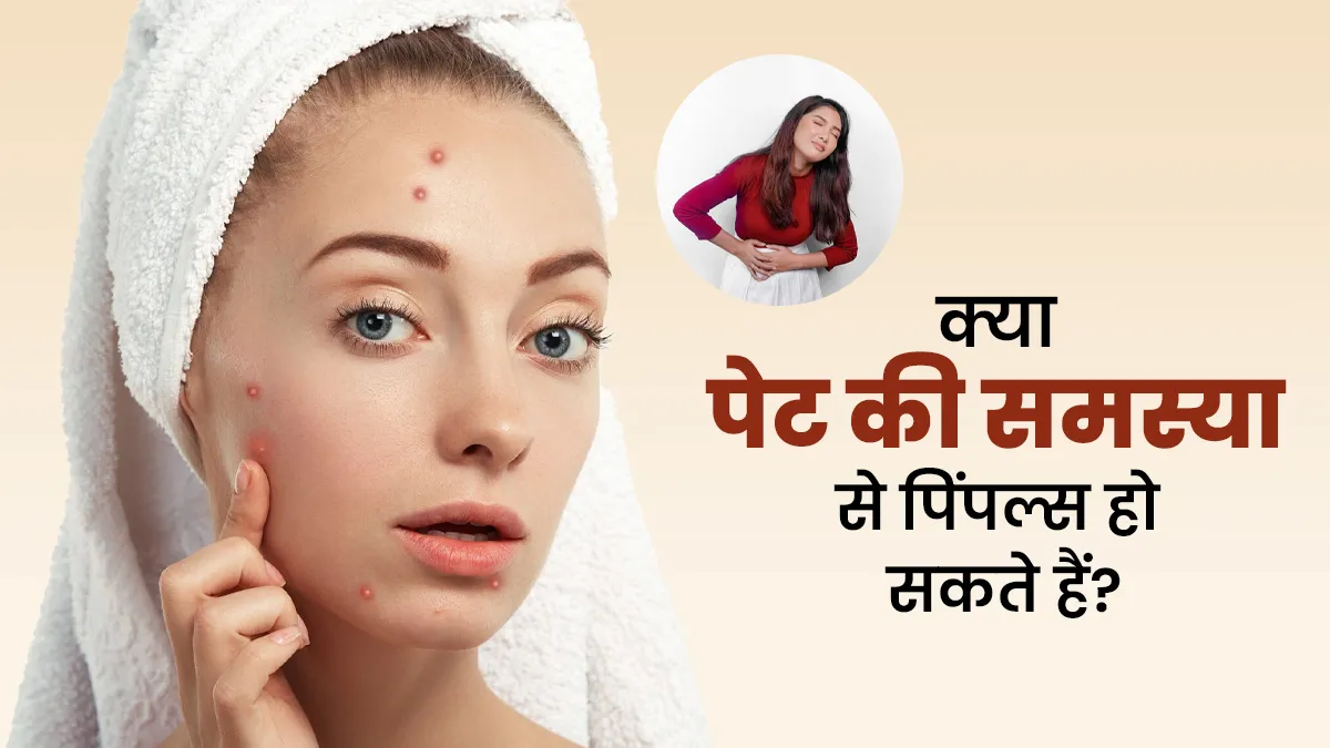चेहरे पर पिंपल्स होने का पेट से क्या कनेक्शन है? जानें डॉक्टर से