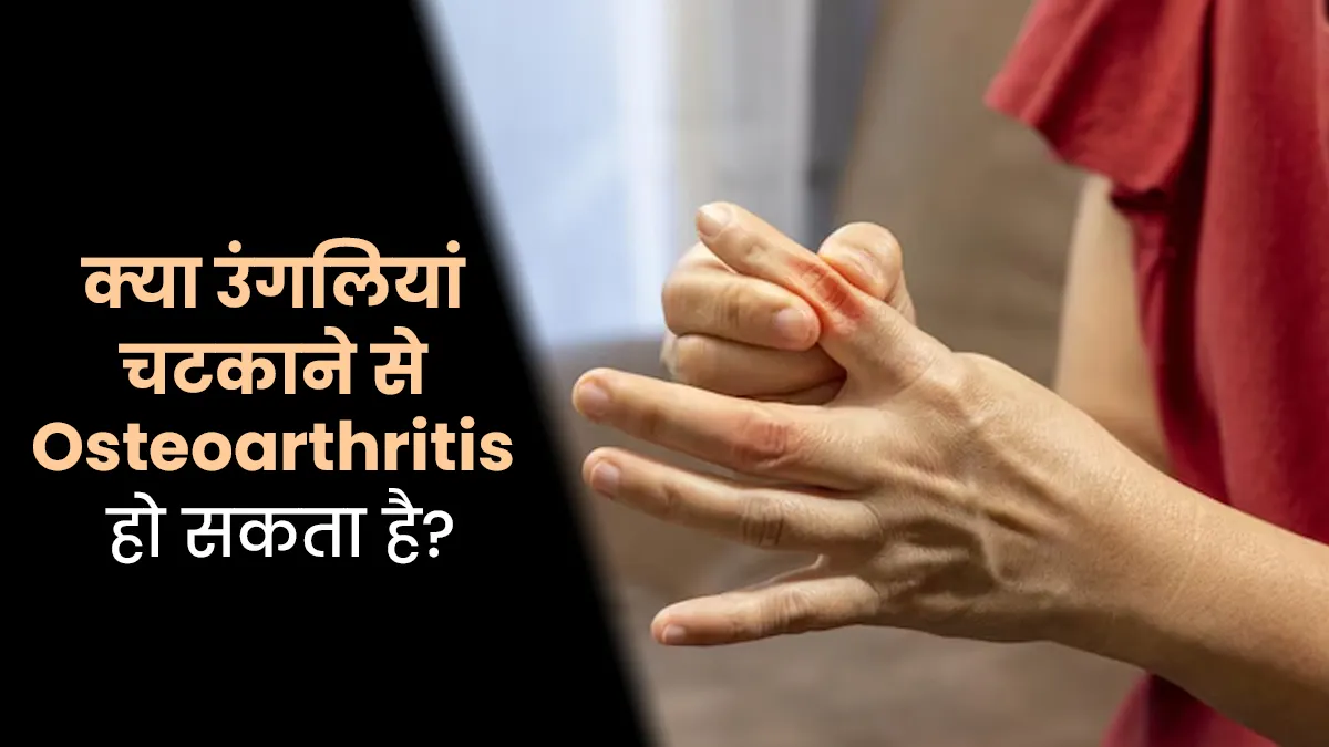 क्या उंगलियां चटकाने से ऑस्टियोआर्थराइटिस हो सकता है? जानें क्या कहते हैं डॉक्टर

