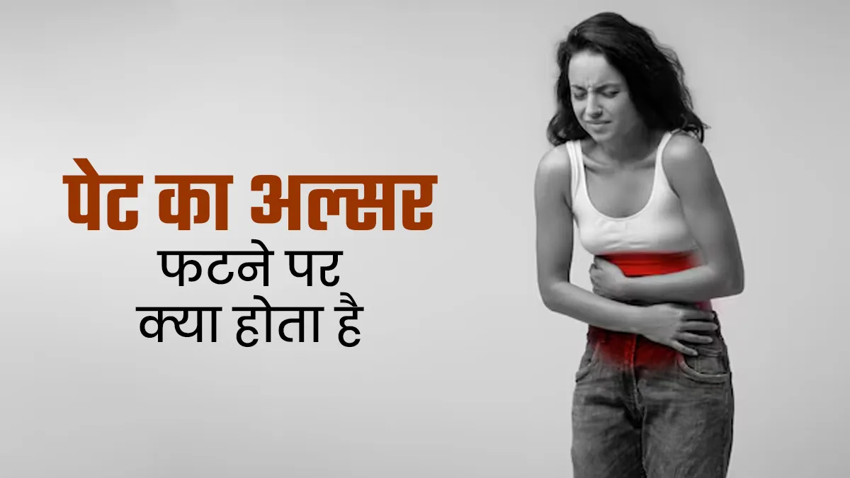 क्या पेट का अल्सर फटना जानलेवा हो सकता है? मानें डॉक्टर की बात