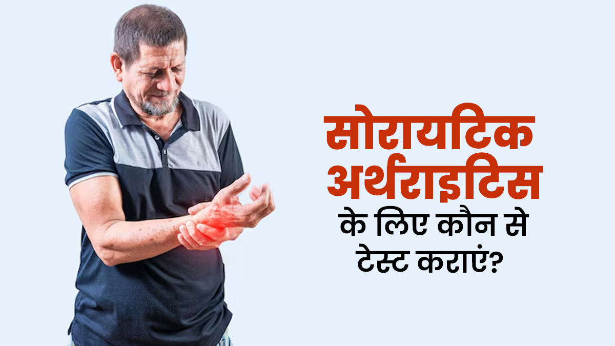 सोरायटिक अर्थराइटिस के लिए कौन से मेडिकल टेस्ट कराना होता है जरूरी? जानें डॉक्टर से