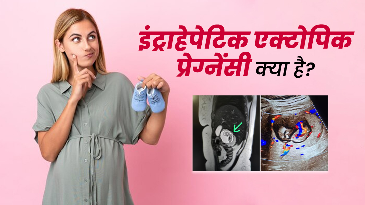 क्या है इंट्राहेपेटिक एक्टोपिक प्रेग्नेंसी (लिवर में भ्रूण)? डॉक्टर से जानें इसके कारण और लक्षण