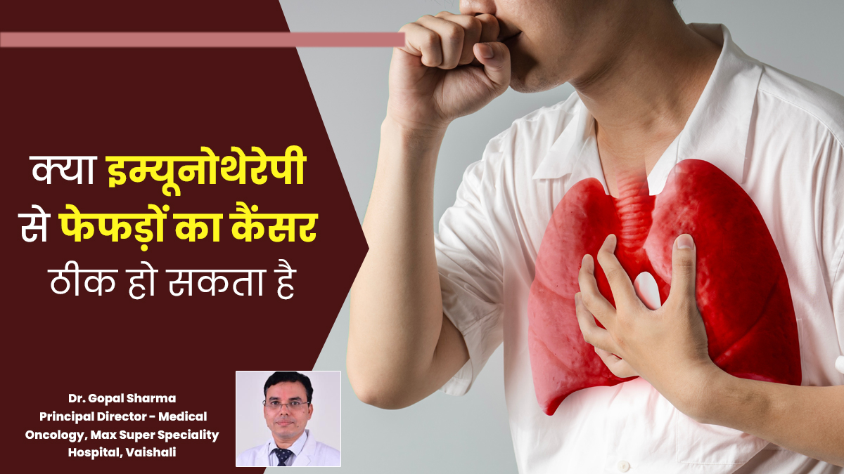 क्या इम्यूनोथेरेपी से फेफड़ों का कैंसर ठीक हो सकता है? बता रहे हैं डॉक्टर