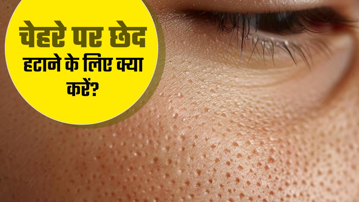 चेहरे के ओपन पोर्स से हैं परेशान? अपनाएं ये 5 घरेलू उपाय और पाएं ग्लास स्किन!
